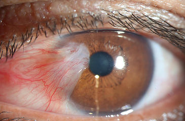 0e0215_d55011089edeb559ec8aacc54bc642b0.png_srz_365_240_85_22_0.50_1.20_0.00_png_srz