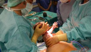 1024px-caesarian_section_-_pull_out