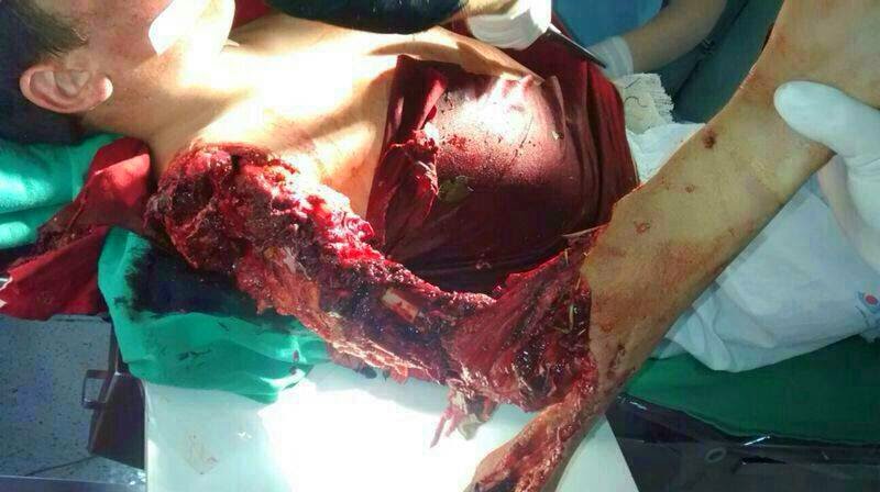 10588605_550602715051711_172365962_n