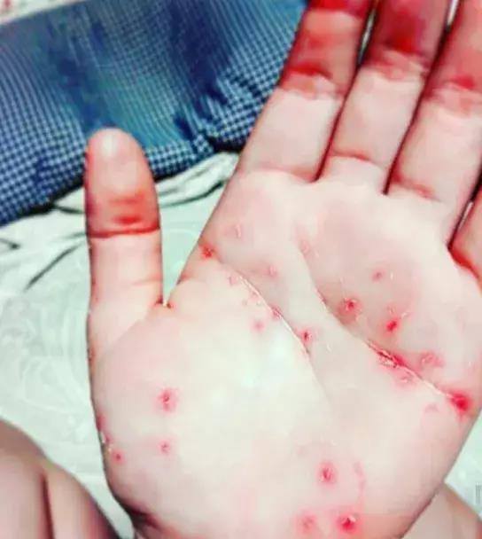 19510662_1754282121253802_7821697698936284225_n