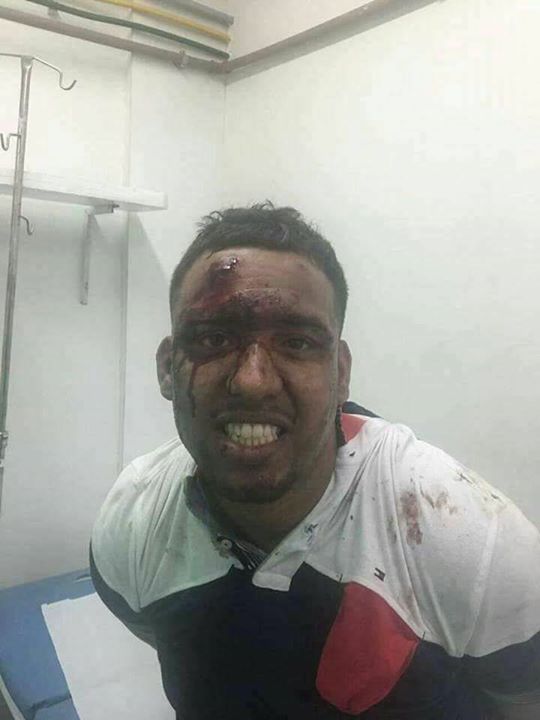 20376022_1980079908870785_4110408183500482654_n