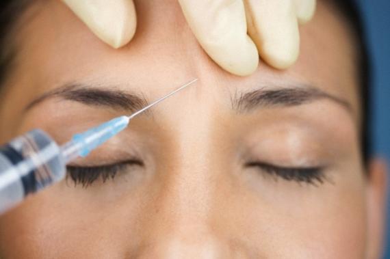 acido-hialuronico-ou-toxina-botulinica-5-590