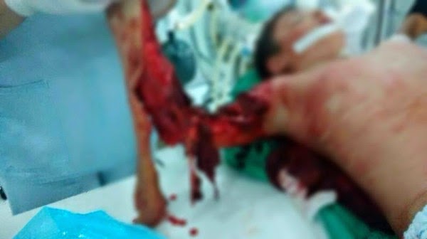 candeiasmix_brincou-com-tigre