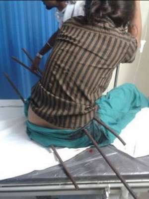 candeiasmix_indiasobreviventebarrasferrorepdailymail