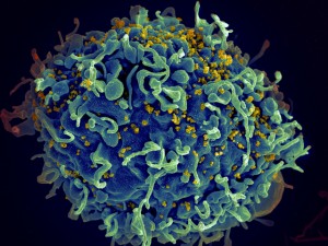 hiv_03_infected1_full