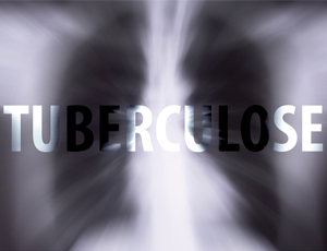 tuberculose_noticia1
